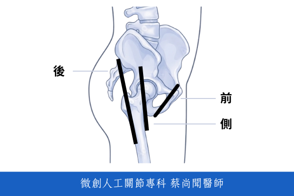 1. 傷口兩週內需保持乾燥不要碰水拷貝2